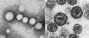 Figura 0: Imágenes tomadas al microscopio electrónico de exosomas aislados de la orina (izquierda) y de viriones de VIH aislado de un cultivo celular (derecha)