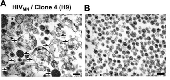 Figura 4: Purificación de viriones de VIH mediante inmunoprecipitación con anticuerpos frente a la proteína CD45, presente en exosomas. A la izquierda fracción obtenida por ultracentrifugación en gradiente de sacarosa antes del tratamiento y a la derecha parte no precipitada tras el tratamiento con anti-CD45. La barra de la escala representa 200 nm. Puede observarse que tras el tratamiento aparece una muestra de tamaño y morfología homogénea.  Fuente: Trubey, C.M. y col., 2003