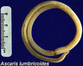 ascaris1